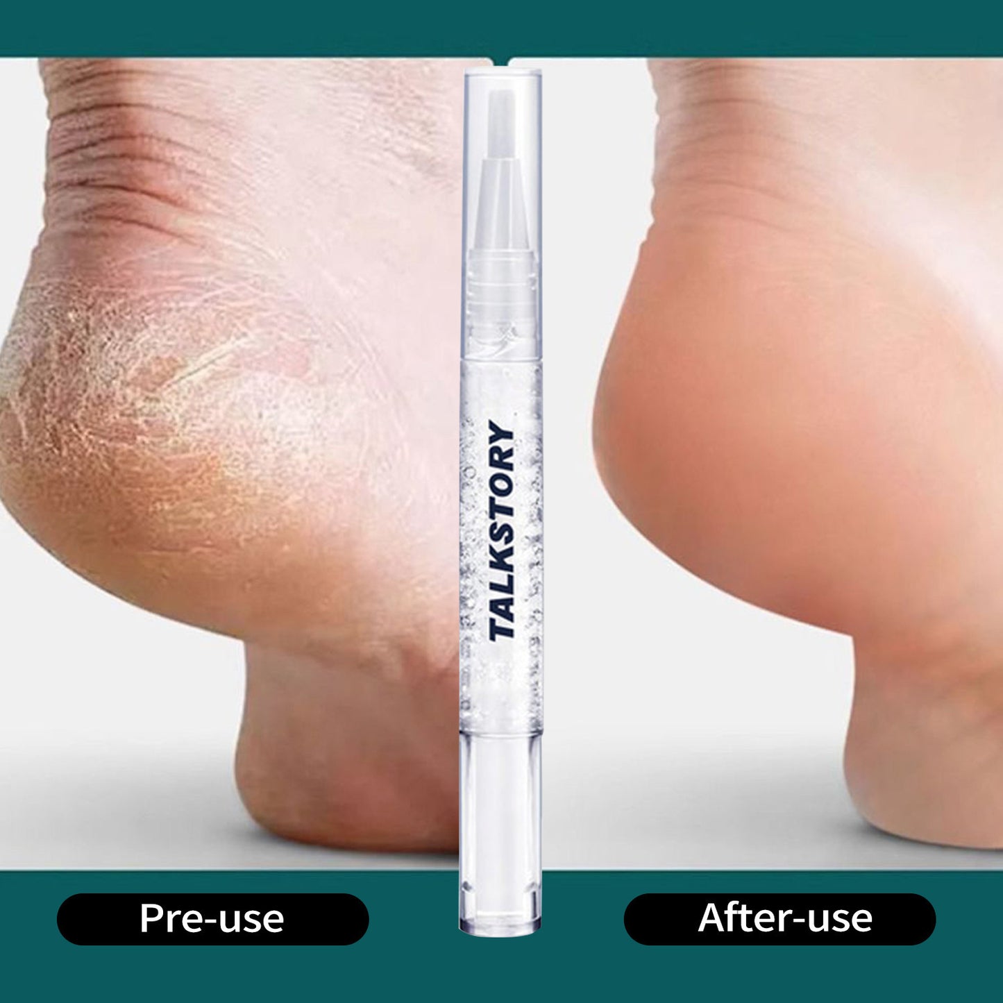 Zavora Antifungal Pen