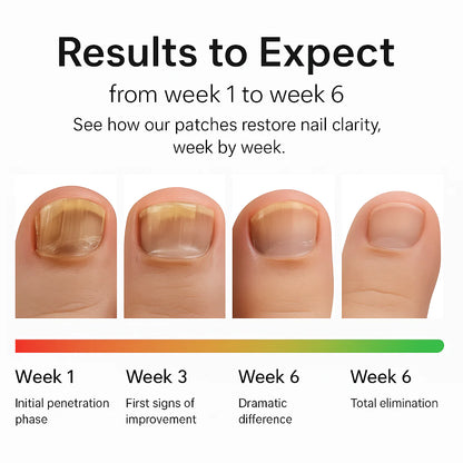 Fungal Nail Repair Patches